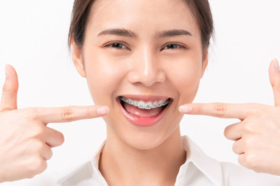 Braces Cost Australia: 7 Key Factors That Affect the Price
